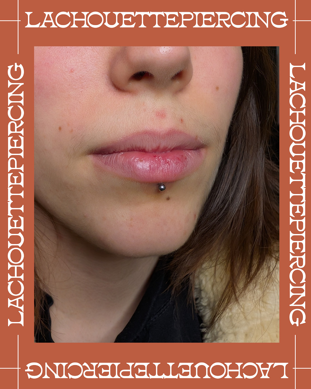 Design sans titre - Tragus